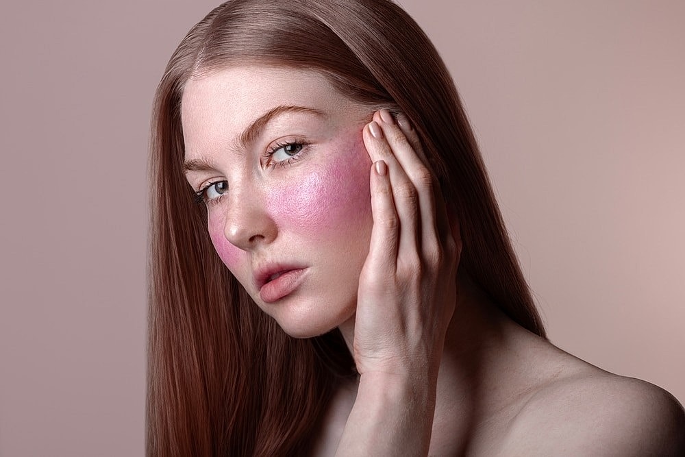 Broadband Light Therapy for Rosacea: Why Salt Lake City Clients Are Loving This Treatment
