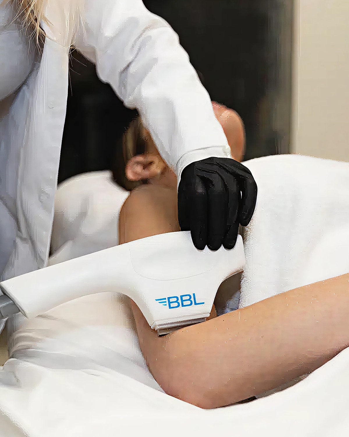BBL treatment being applied to a patient.