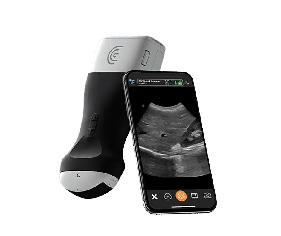 Handheld ultrasound device with smartphone display.